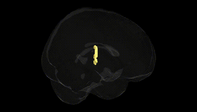 Full Brain Black