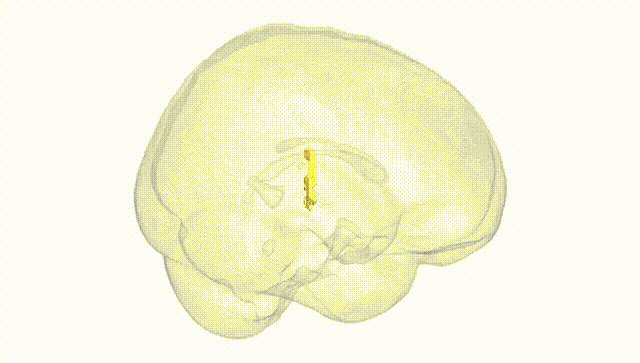 Full Brain White
