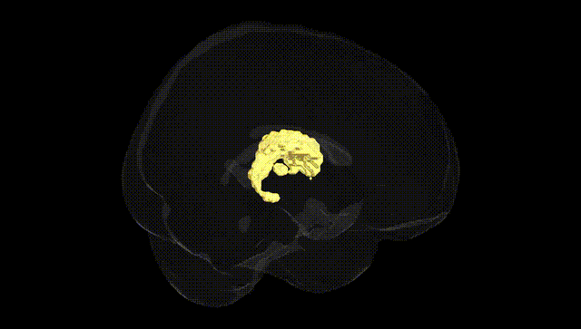 Full Brain Black