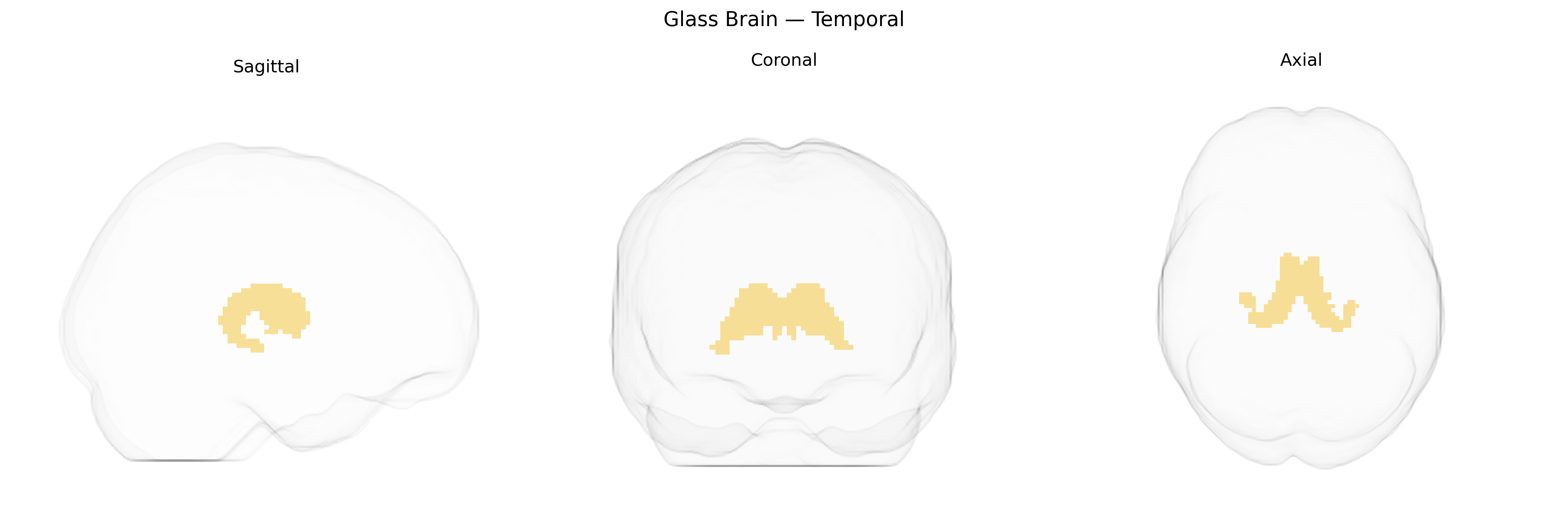 Triplanar Ghost Brain