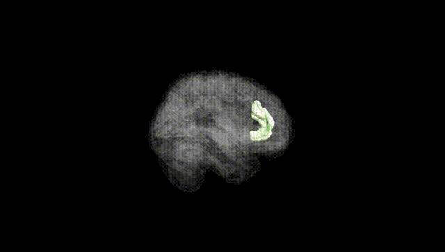 Full Brain Black
