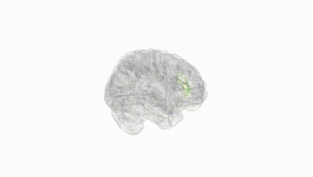 Full Brain White