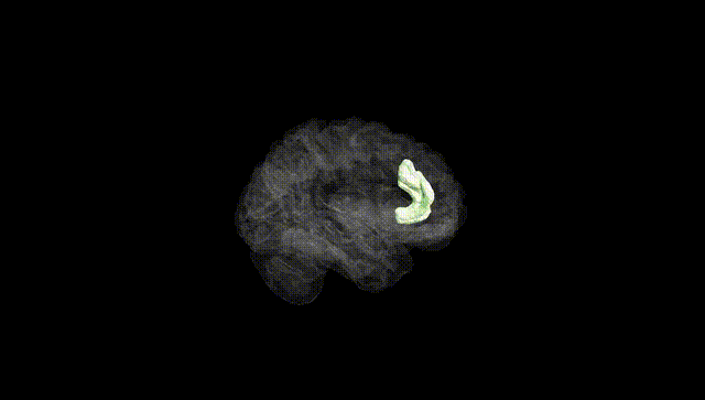Hemisphere Black