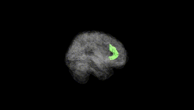 Full Brain Black