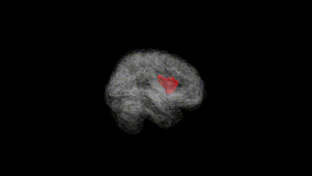 Full Brain Black