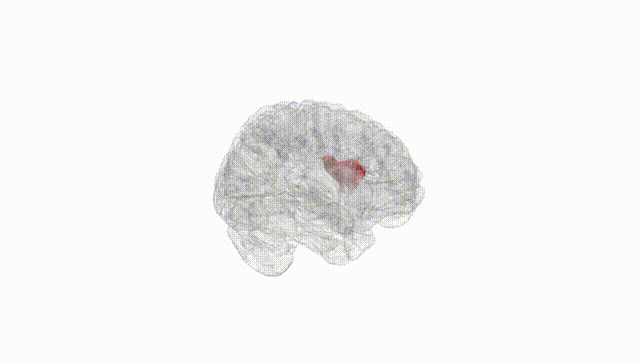 Full Brain White