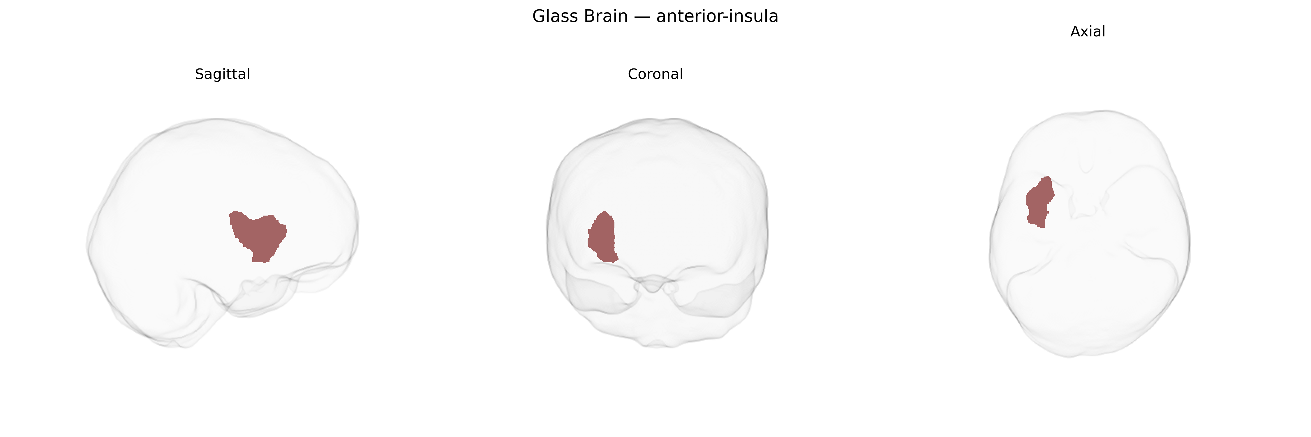Triplanar Ghost Brain