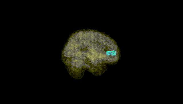 Full Brain Black