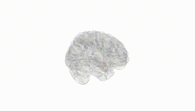 Full Brain White