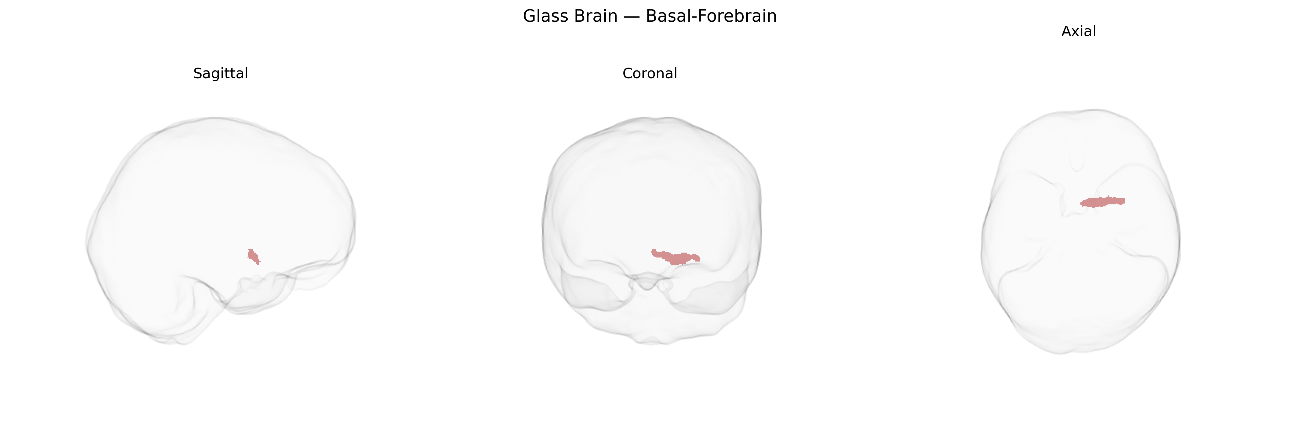 Triplanar Ghost Brain