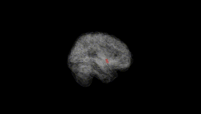 Full Brain Black