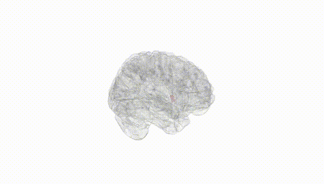 Full Brain White