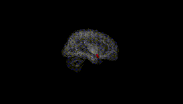 Hemisphere Black