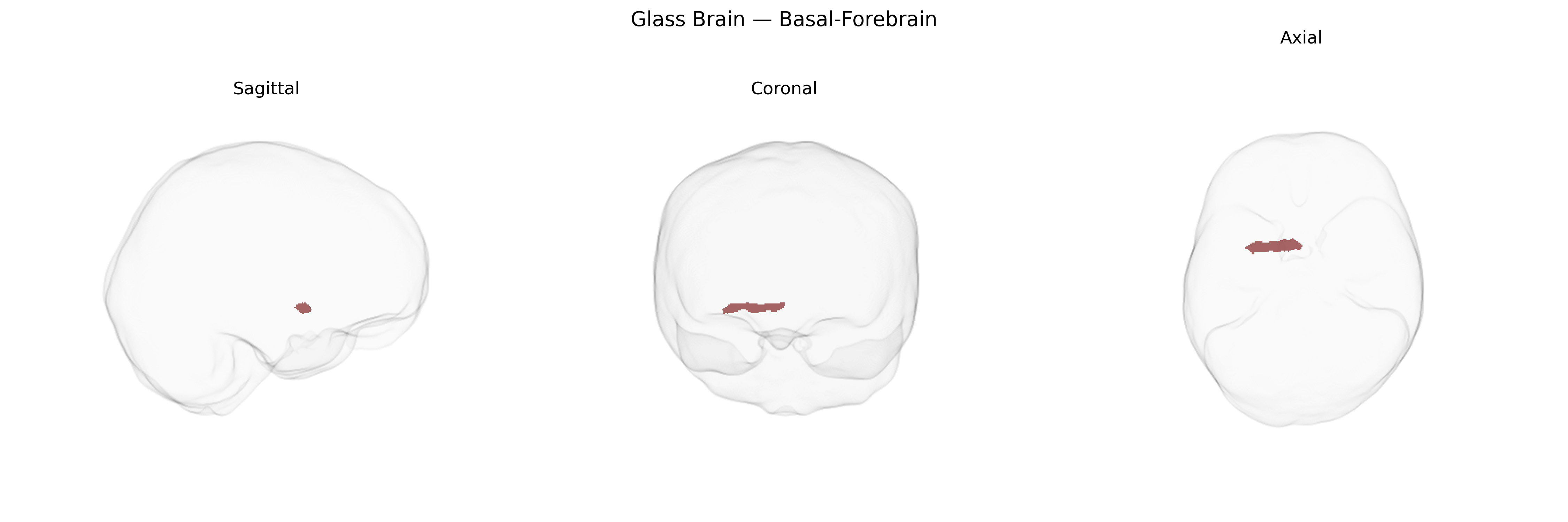 Triplanar Ghost Brain