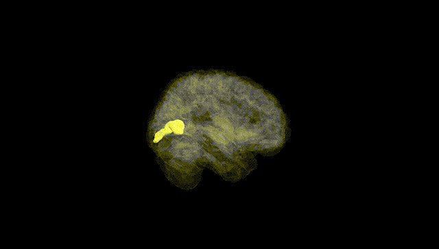 Full Brain Black