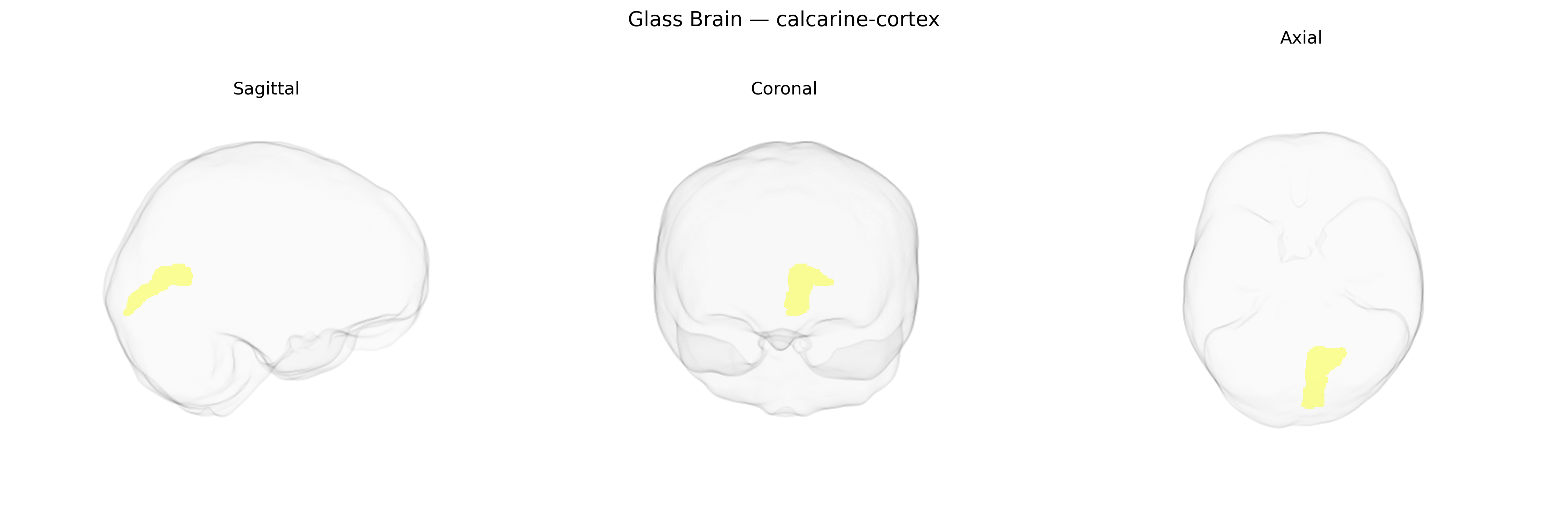 Triplanar Ghost Brain