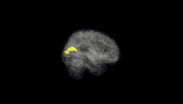 Full Brain Black