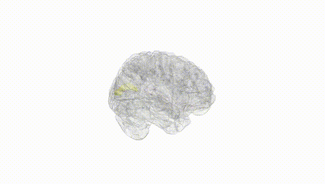 Full Brain White
