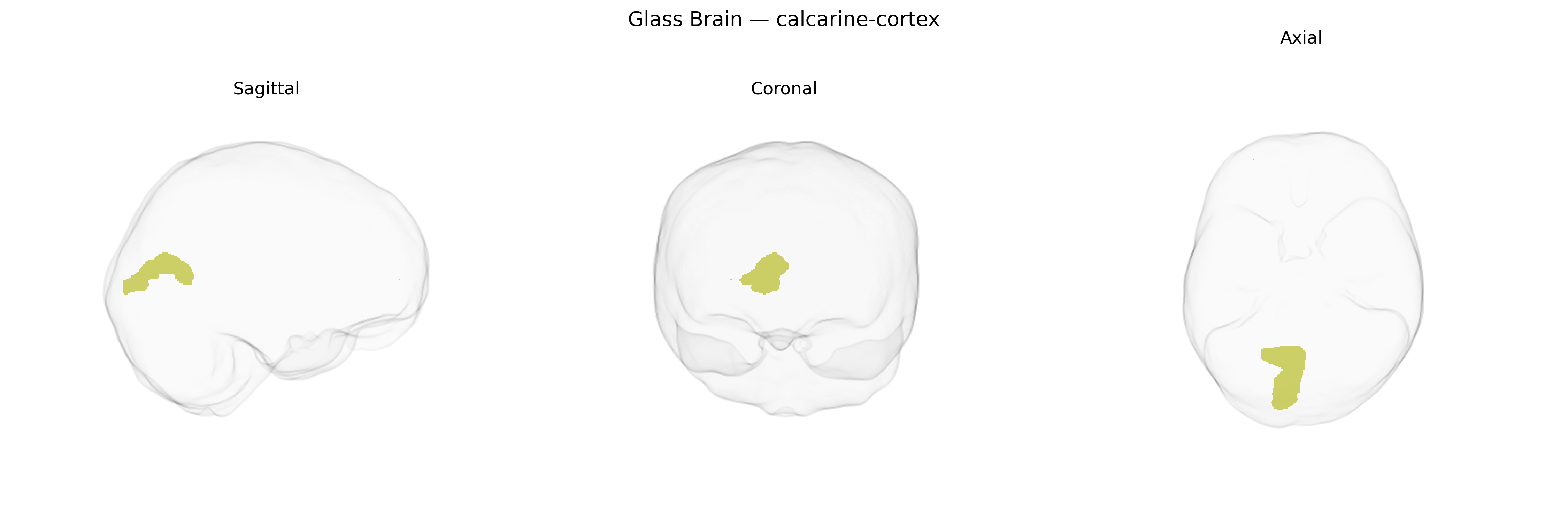 Triplanar Ghost Brain