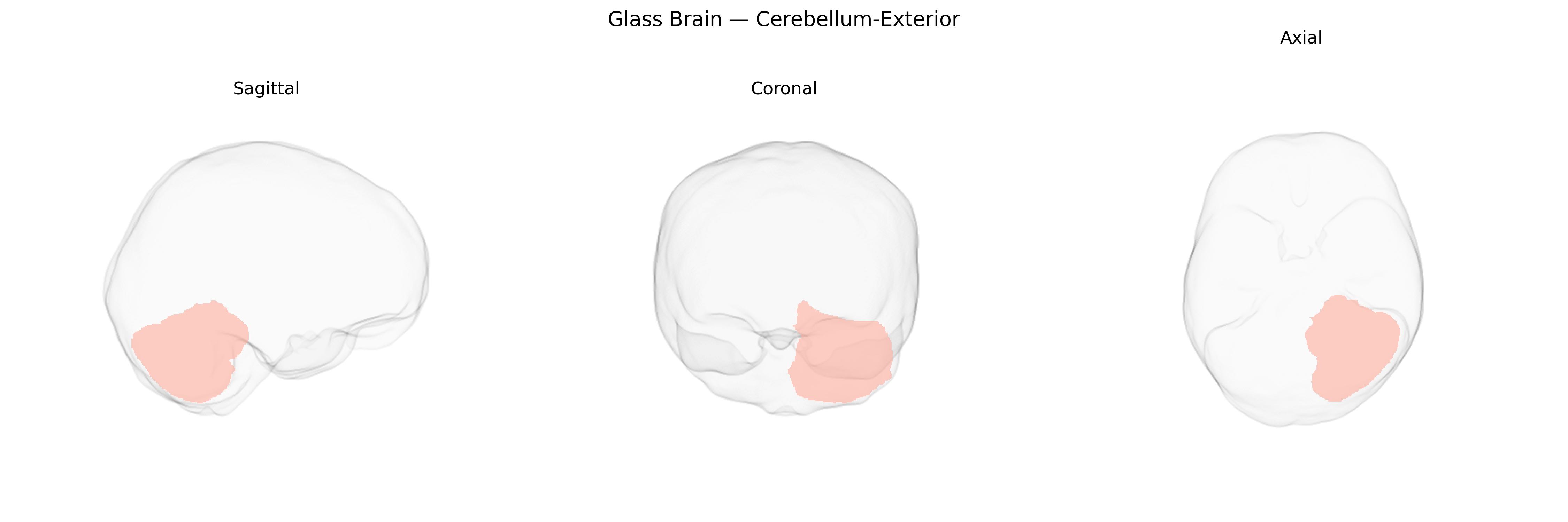 Triplanar Ghost Brain