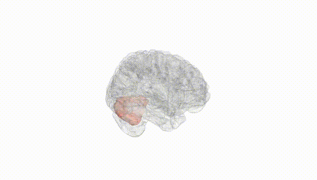 Full Brain White