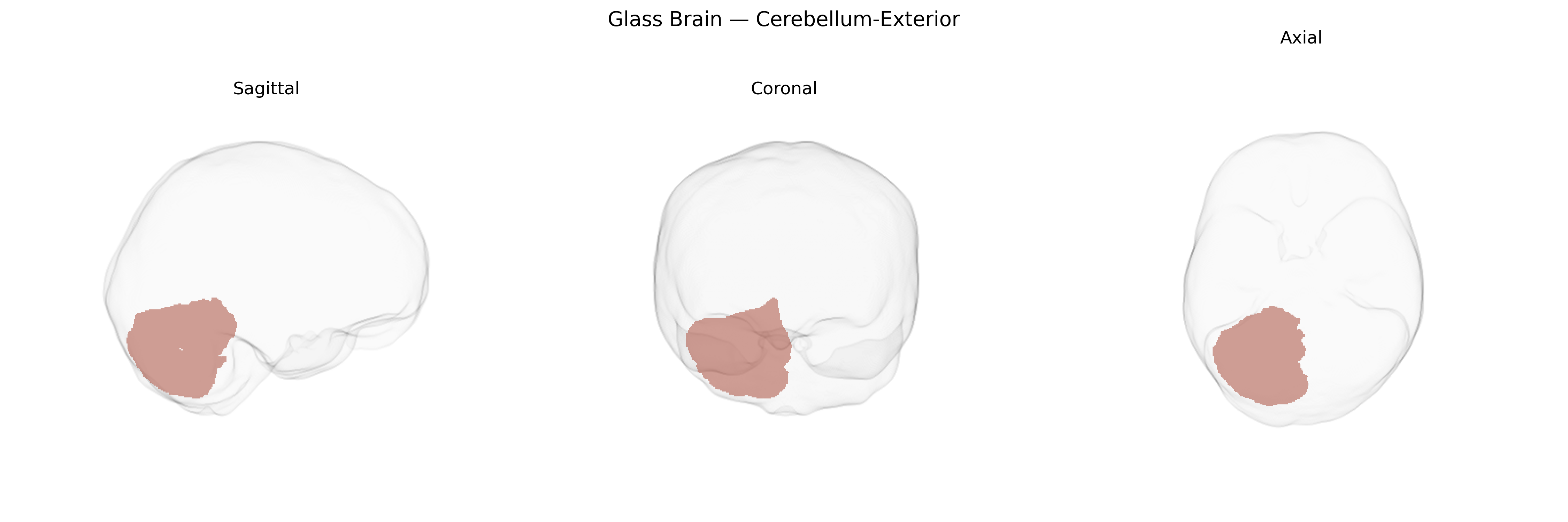 Triplanar Ghost Brain