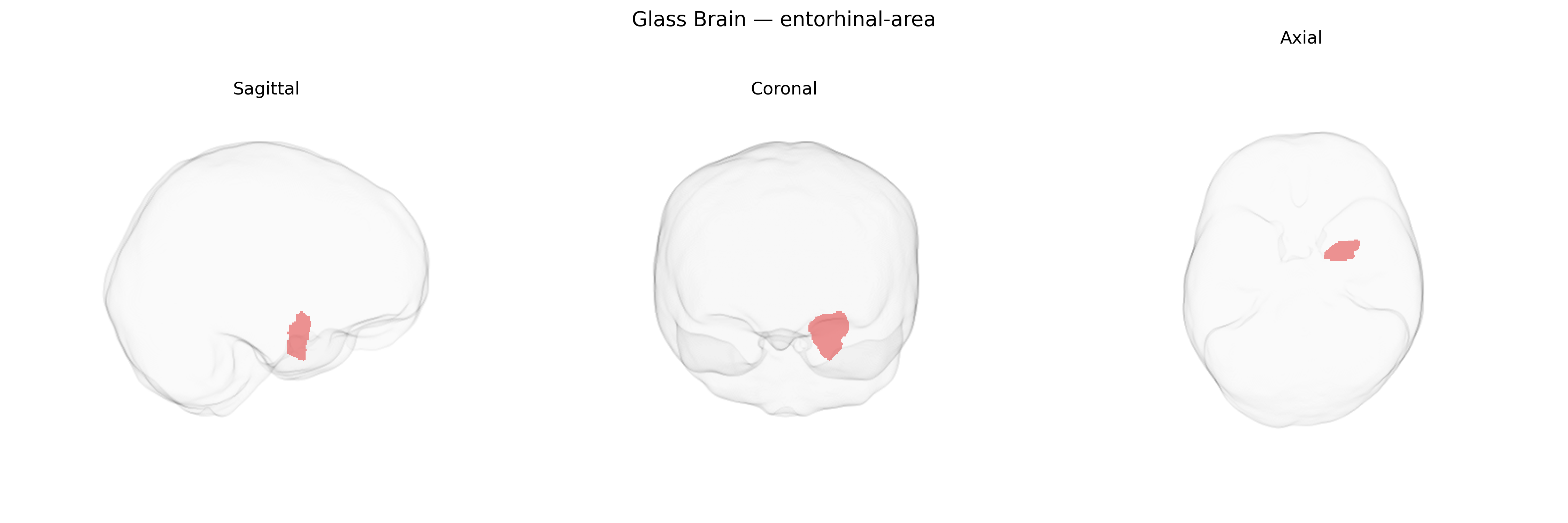 Triplanar Ghost Brain