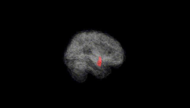 Full Brain Black