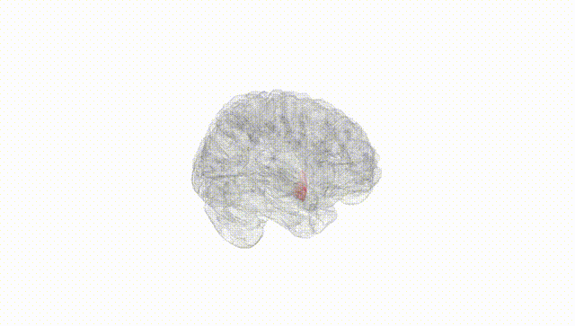 Full Brain White