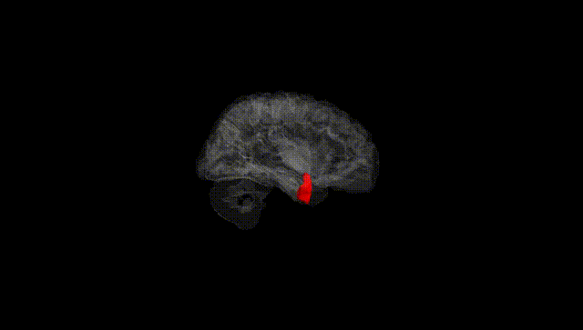 Hemisphere Black