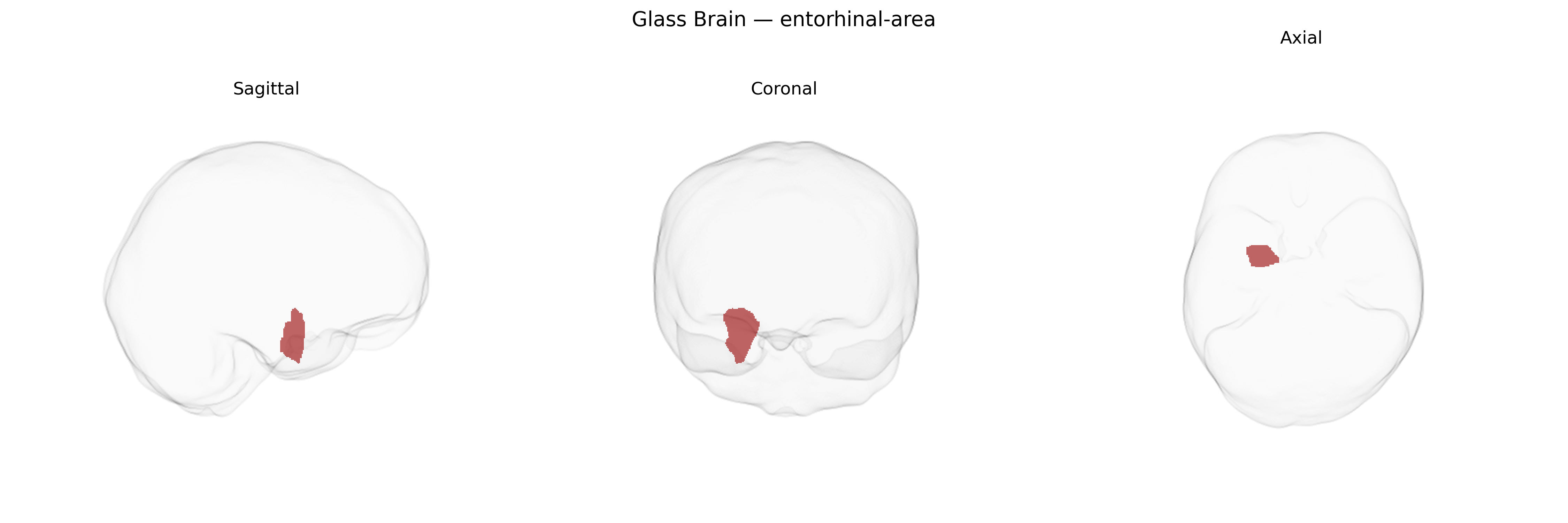 Triplanar Ghost Brain