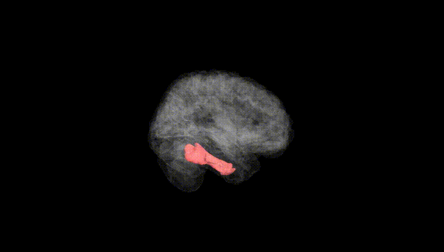 Full Brain Black