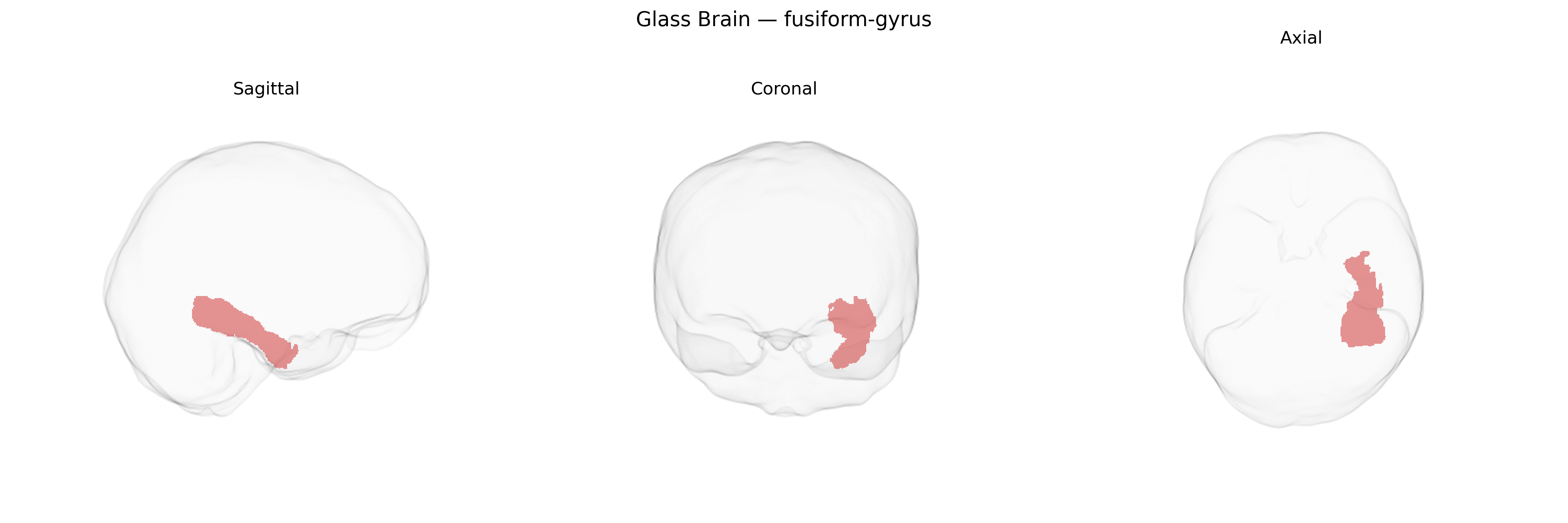 Triplanar Ghost Brain