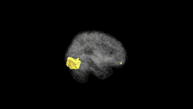 Full Brain Black