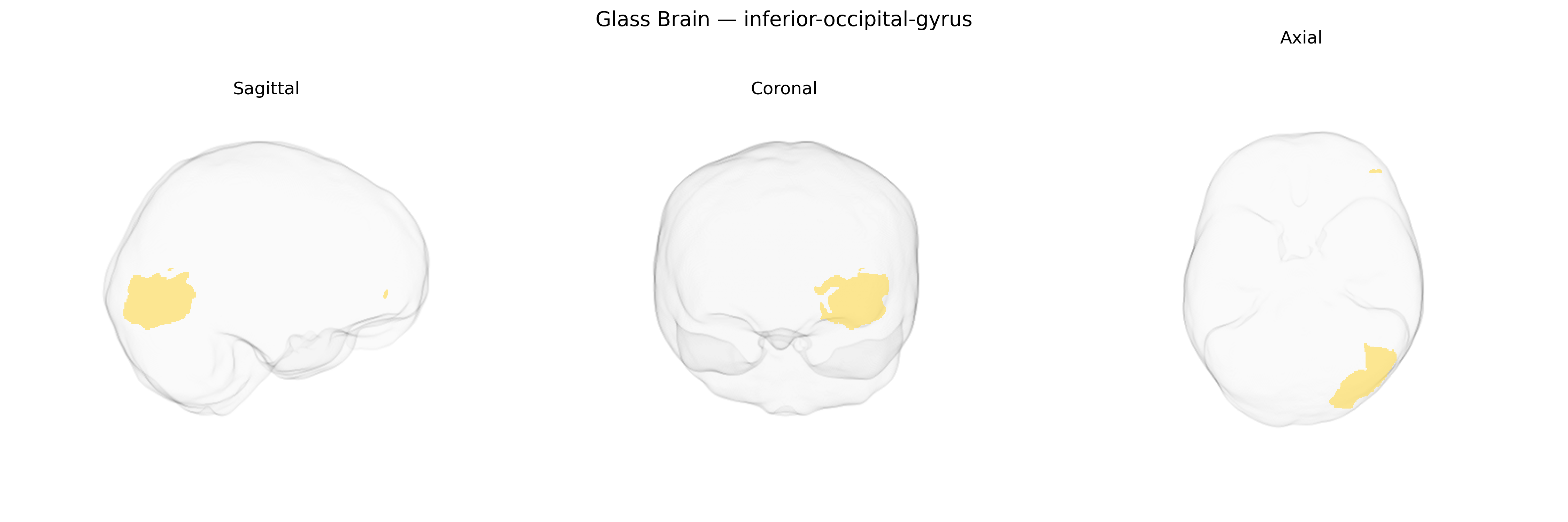 Triplanar Ghost Brain