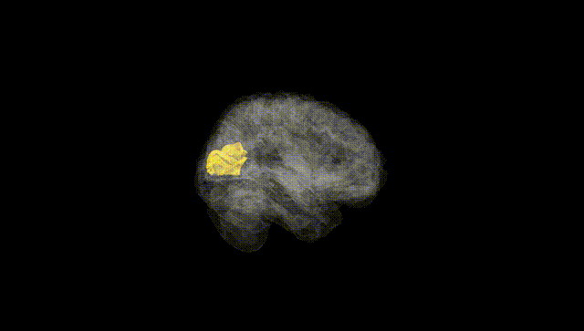 Full Brain Black
