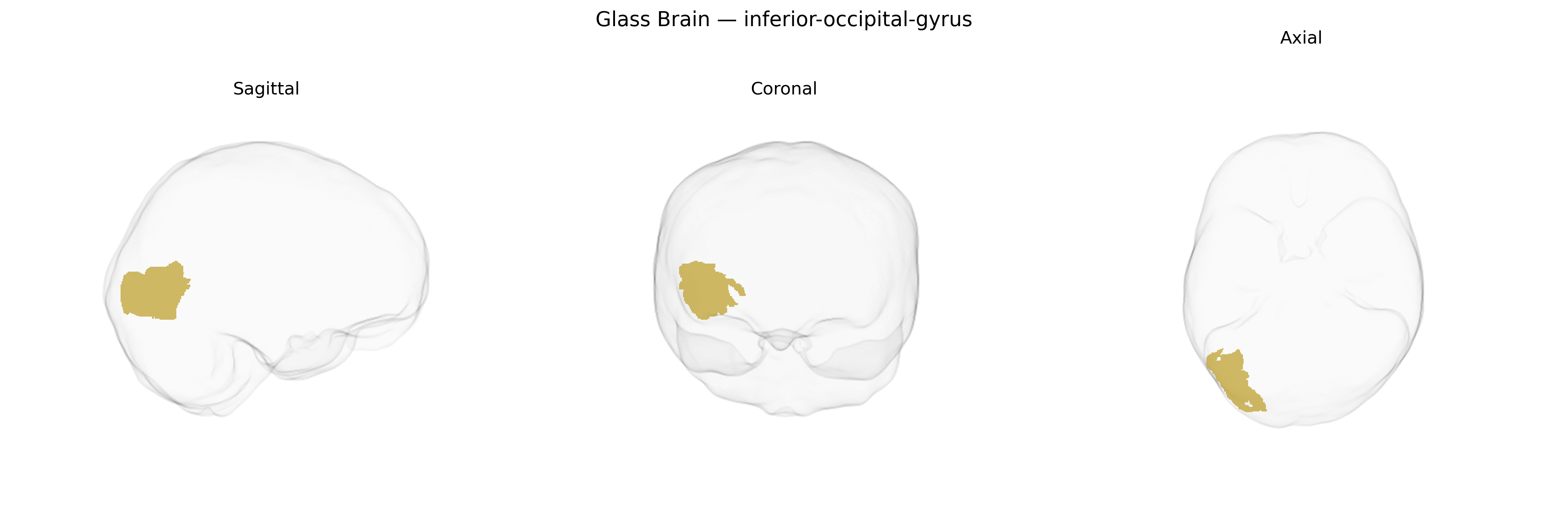 Triplanar Ghost Brain
