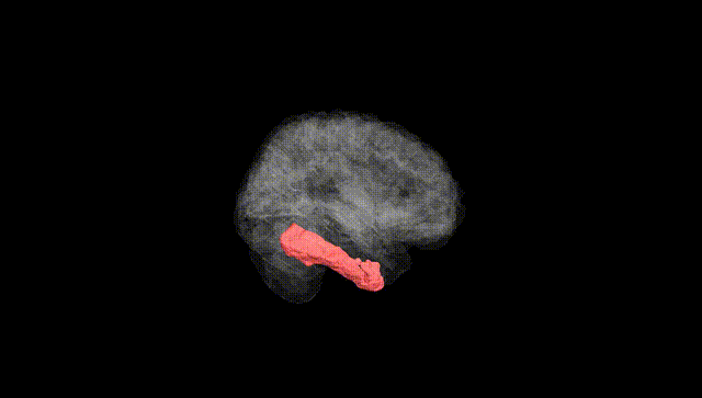 Full Brain Black