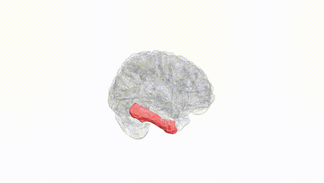 Full Brain White
