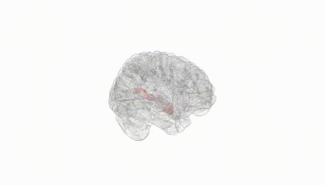 Full Brain White
