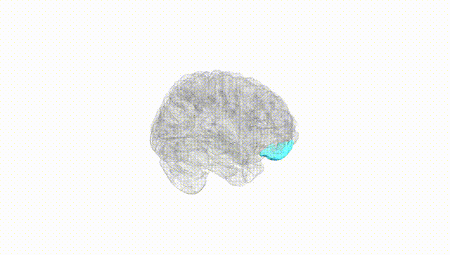 Full Brain White