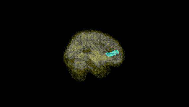 Full Brain Black