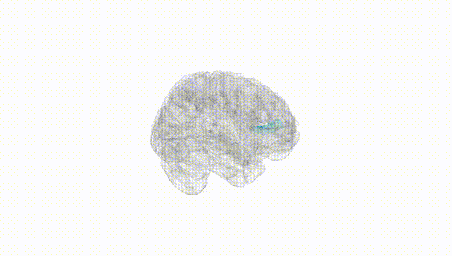 Full Brain White