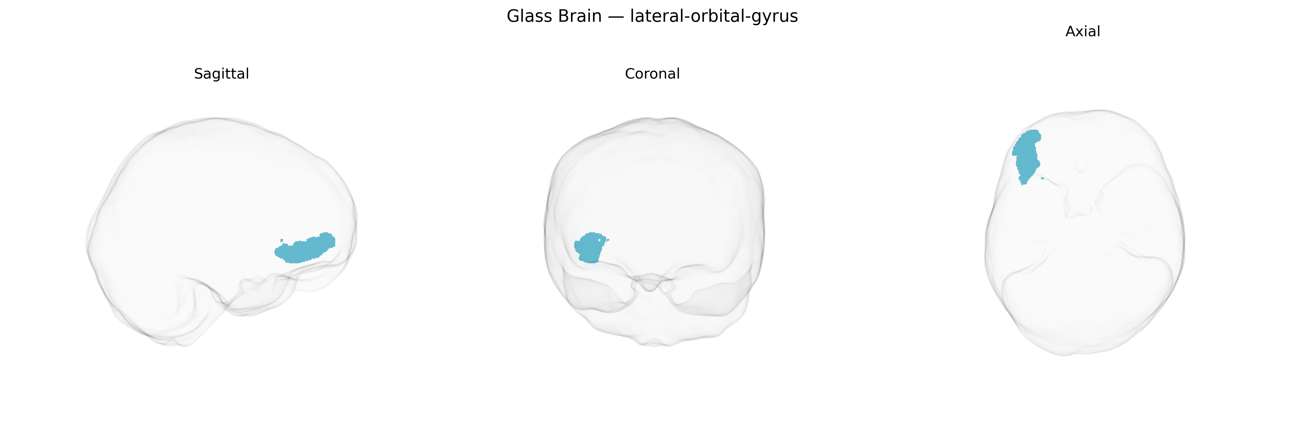 Triplanar Ghost Brain