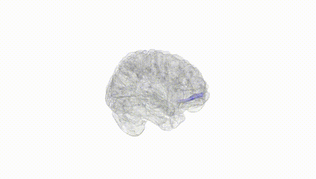 Full Brain White