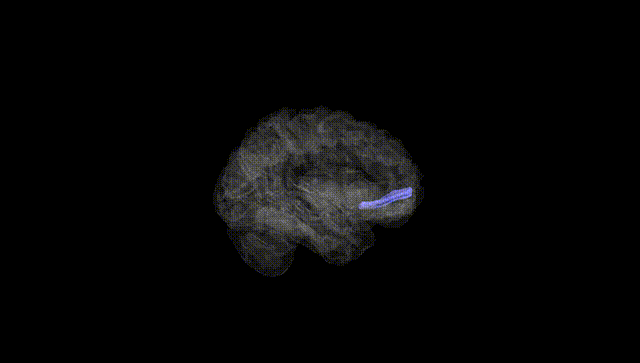 Hemisphere Black