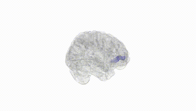 Full Brain White