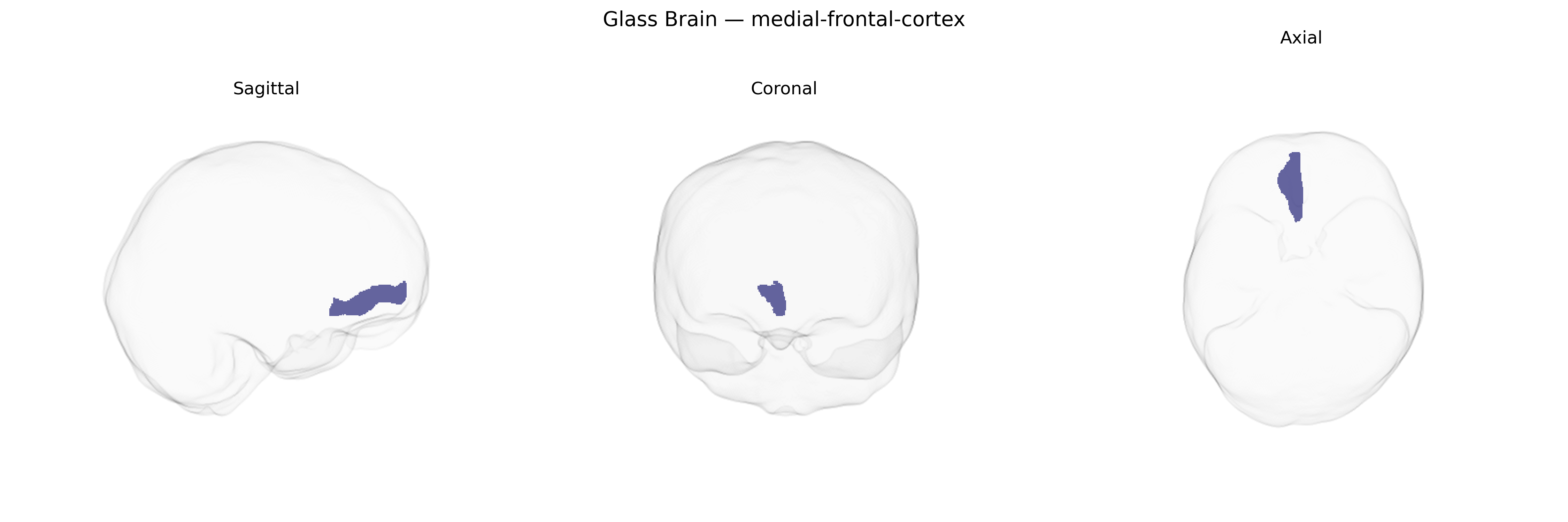 Triplanar Ghost Brain