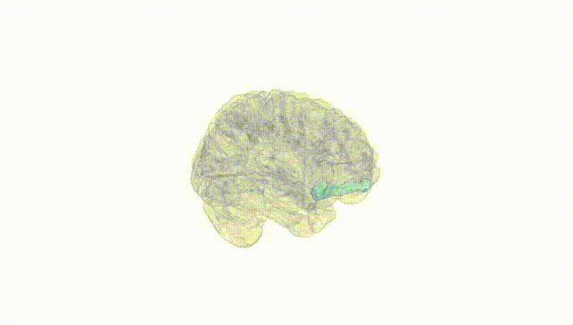 Full Brain White