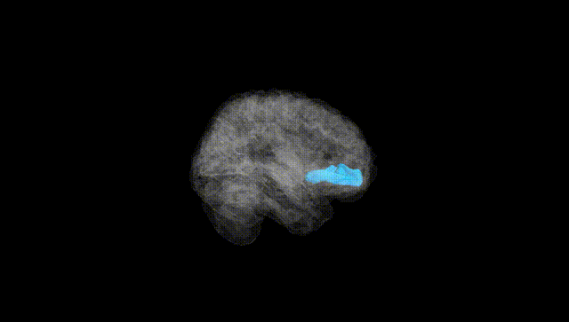 Full Brain Black